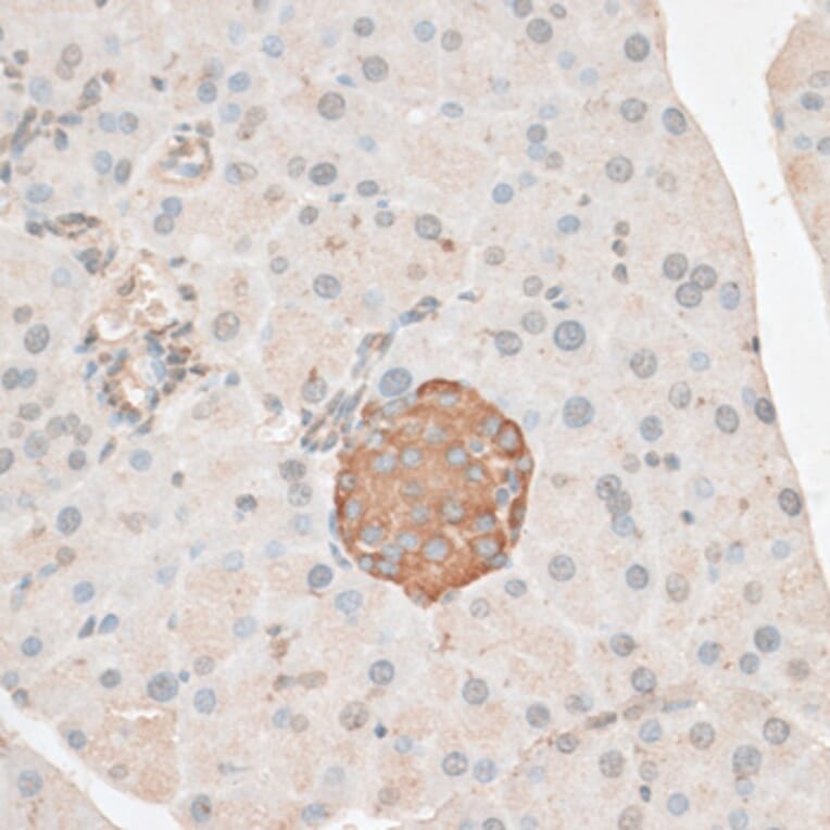 Immunohistochemistry - Anti-PDP2 Antibody (A14416) - Antibodies.com