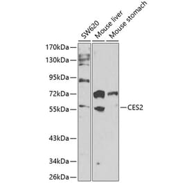 Western Blot - Anti-CES2 Antibody (A90596) - Antibodies.com