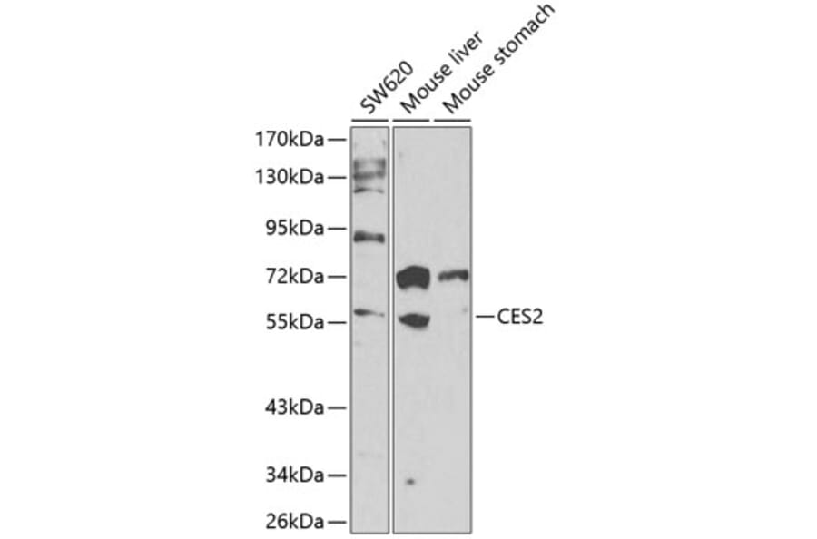 Western Blot - Anti-CES2 Antibody (A90596) - Antibodies.com