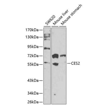 Western Blot - Anti-CES2 Antibody (A90596) - Antibodies.com