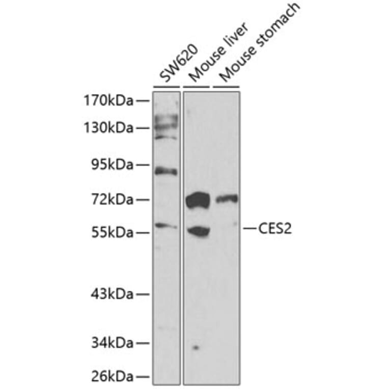 Western Blot - Anti-CES2 Antibody (A90596) - Antibodies.com