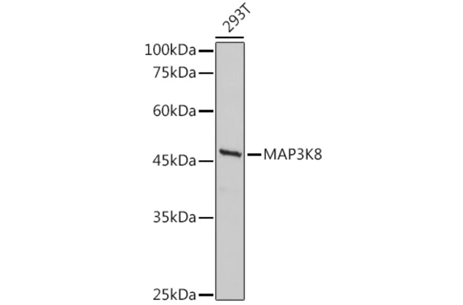 Western Blot - Anti-MAP3K8/COT Antibody (A90597) - Antibodies.com