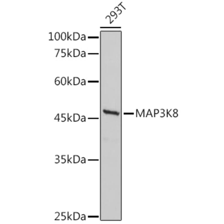 Western Blot - Anti-MAP3K8/COT Antibody (A90597) - Antibodies.com