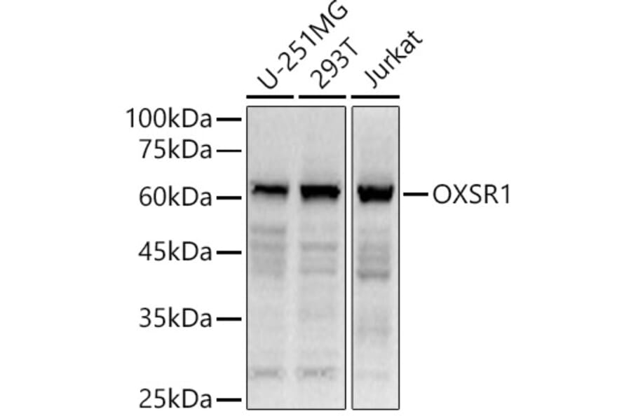 Western Blot - Anti-OXSR1 Antibody (A90598) - Antibodies.com
