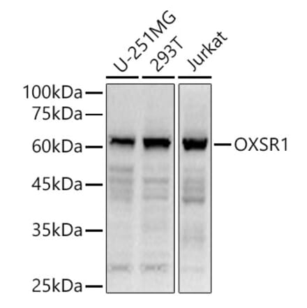 Western Blot - Anti-OXSR1 Antibody (A90598) - Antibodies.com
