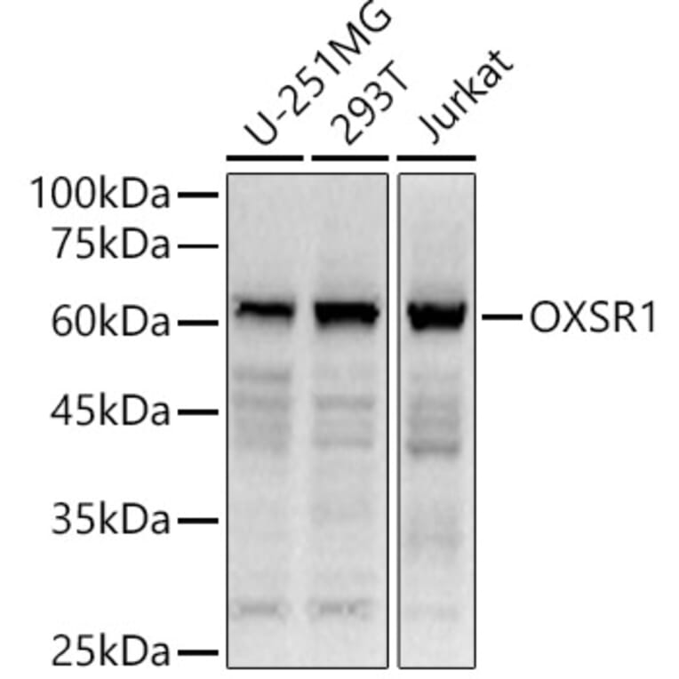 Western Blot - Anti-OXSR1 Antibody (A90598) - Antibodies.com