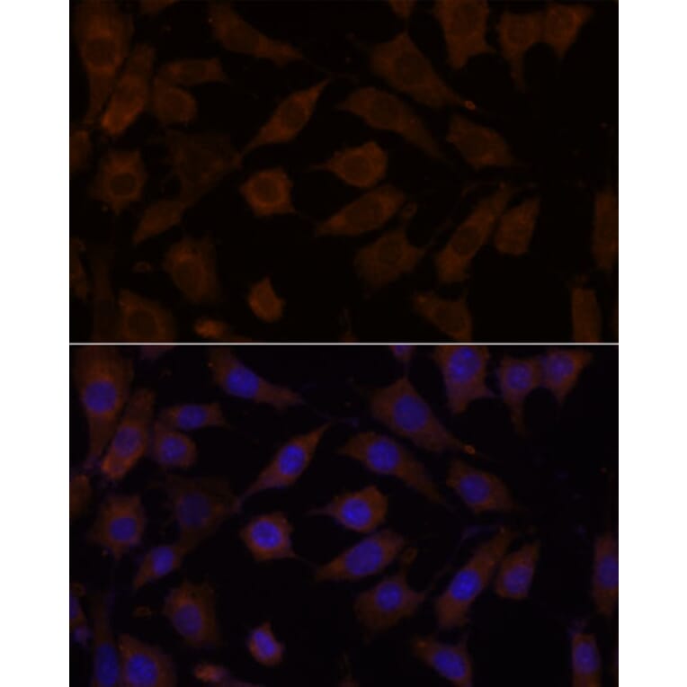 Immunofluorescence - Anti-OXSR1 Antibody (A90598) - Antibodies.com