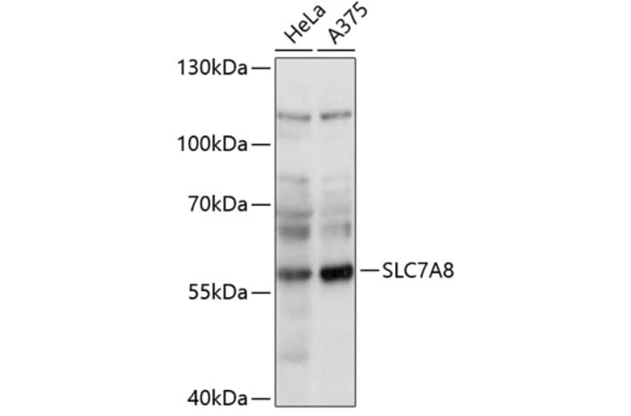 Western Blot - Anti-LAT2 Antibody (A90599) - Antibodies.com