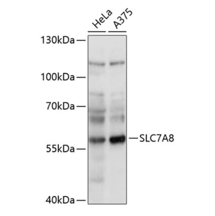 Western Blot - Anti-LAT2 Antibody (A90599) - Antibodies.com