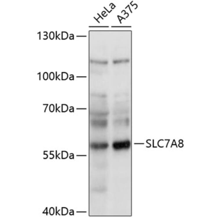 Western Blot - Anti-LAT2 Antibody (A90599) - Antibodies.com