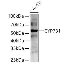Western Blot - Anti-CYP7B1 Antibody (A90601) - Antibodies.com