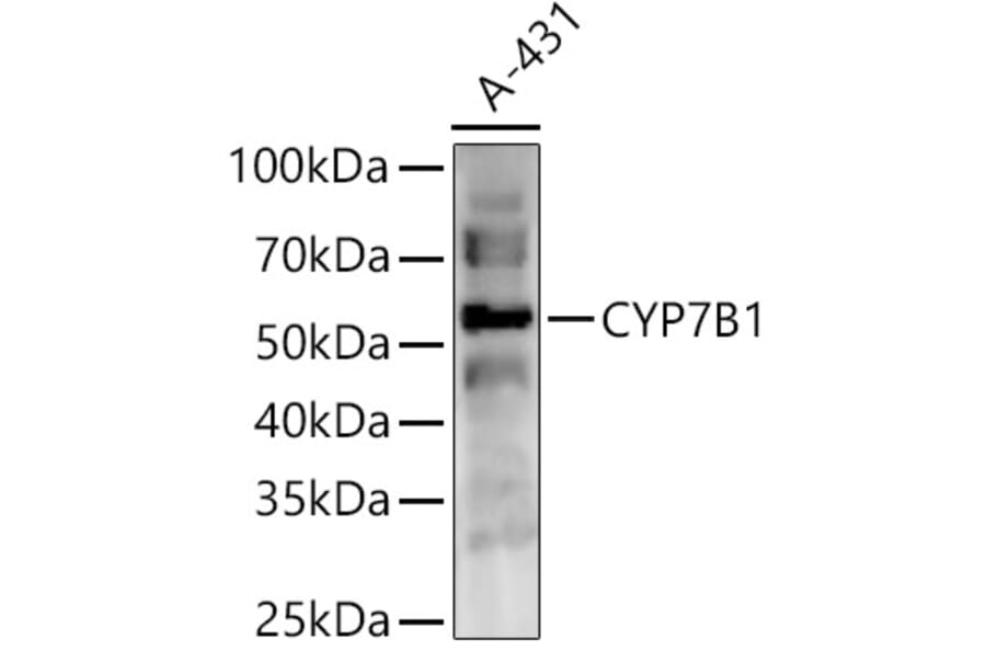 Western Blot - Anti-CYP7B1 Antibody (A90601) - Antibodies.com