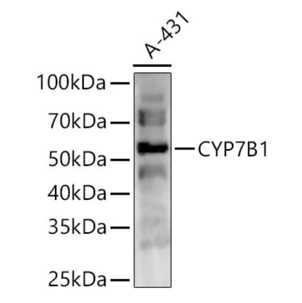 Western Blot - Anti-CYP7B1 Antibody (A90601) - Antibodies.com