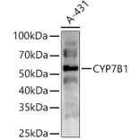 Western Blot - Anti-CYP7B1 Antibody (A90601) - Antibodies.com