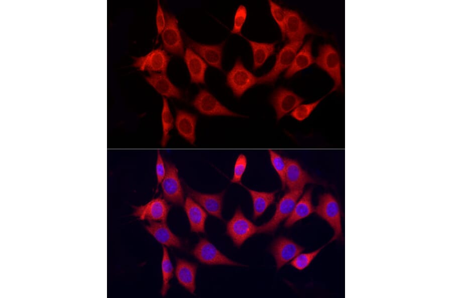 Immunofluorescence - Anti-CYP7B1 Antibody (A90601) - Antibodies.com
