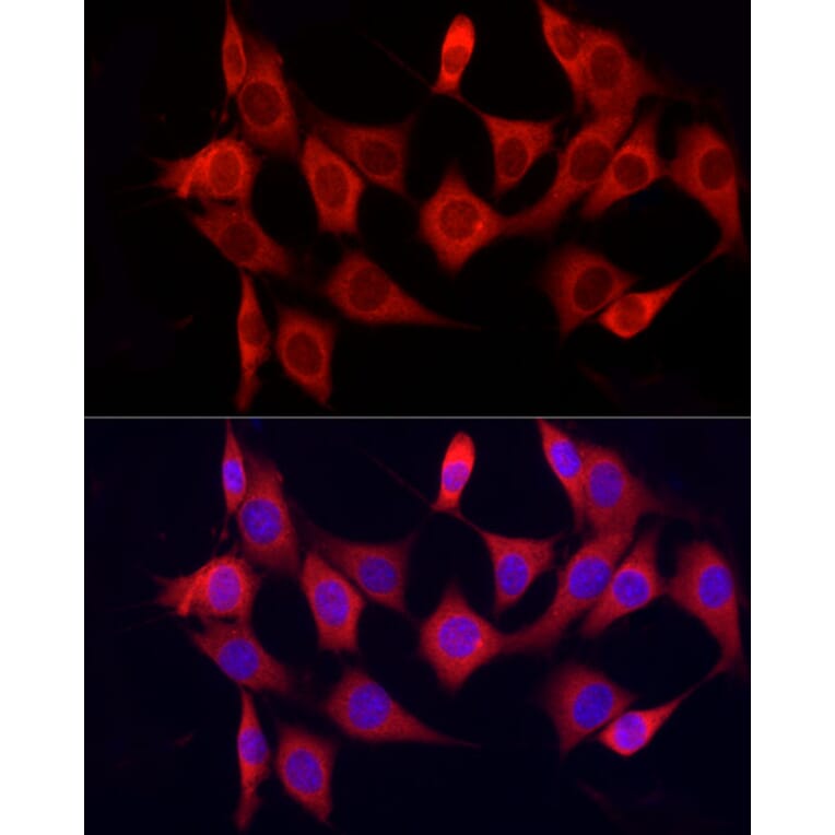 Immunofluorescence - Anti-CYP7B1 Antibody (A90601) - Antibodies.com