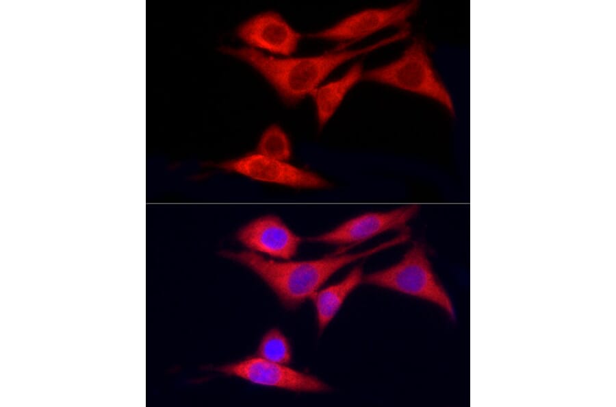 Immunofluorescence - Anti-CYP7B1 Antibody (A90601) - Antibodies.com