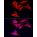 Immunofluorescence - Anti-CYP7B1 Antibody (A90601) - Antibodies.com