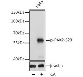 Western Blot - Anti-PAK2 (phospho Ser20) Antibody (A90602) - Antibodies.com