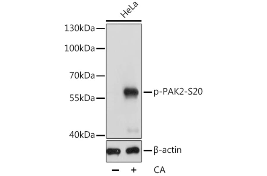 Western Blot - Anti-PAK2 (phospho Ser20) Antibody (A90602) - Antibodies.com