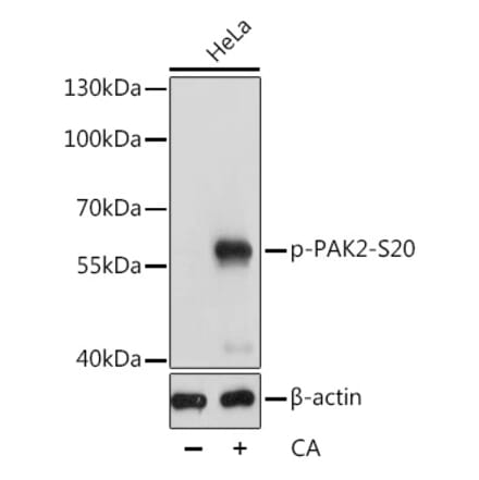 Western Blot - Anti-PAK2 (phospho Ser20) Antibody (A90602) - Antibodies.com