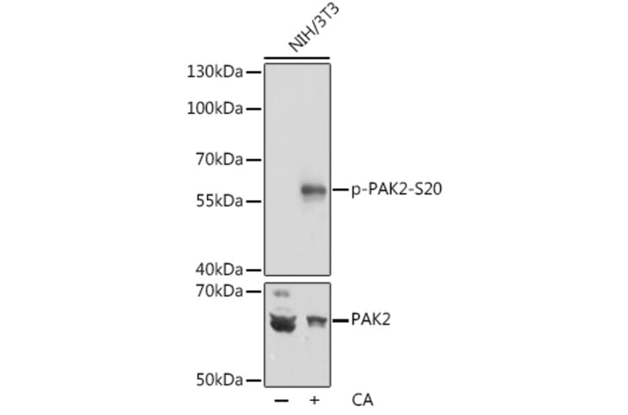 Western Blot - Anti-PAK2 (phospho Ser20) Antibody (A90602) - Antibodies.com