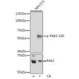 Western Blot - Anti-PAK2 (phospho Ser20) Antibody (A90602) - Antibodies.com