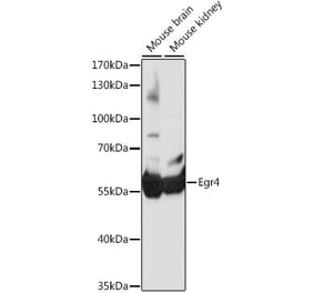 Western Blot - Anti-EGR4 Antibody (A90603) - Antibodies.com