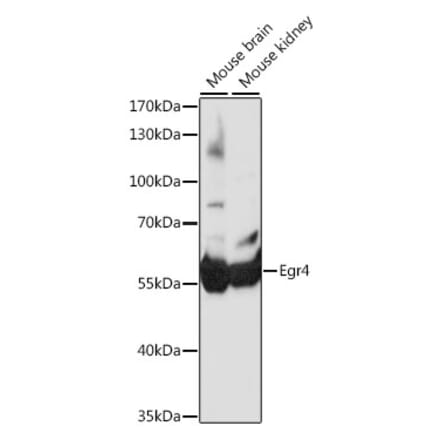 Western Blot - Anti-EGR4 Antibody (A90603) - Antibodies.com