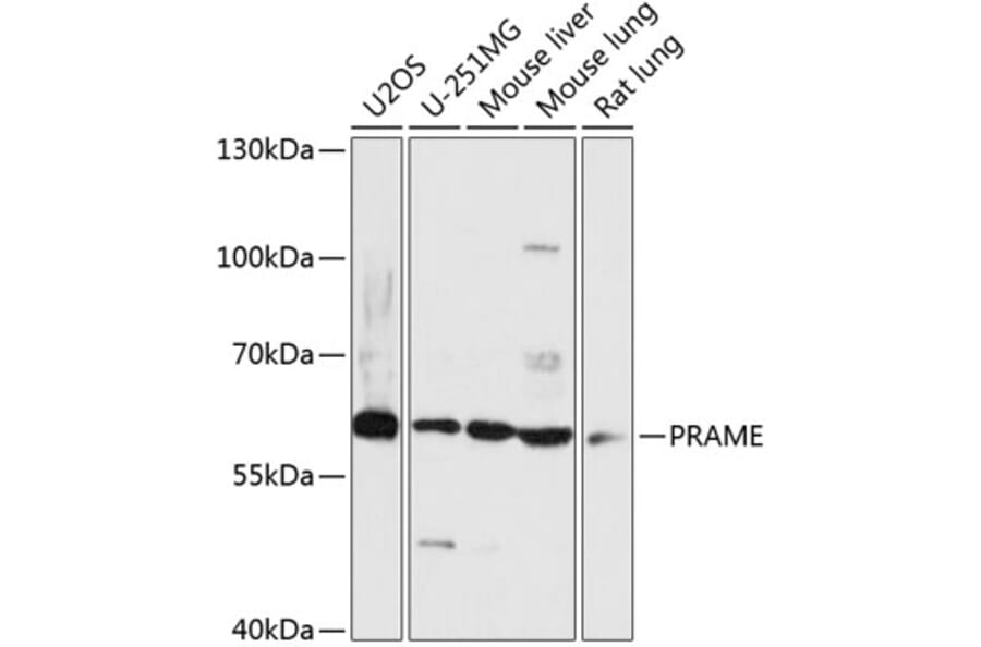 Western Blot - Anti-PRAME Antibody (A90604) - Antibodies.com