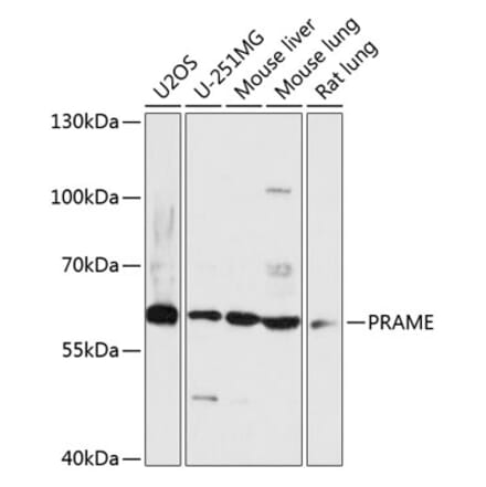 Western Blot - Anti-PRAME Antibody (A90604) - Antibodies.com