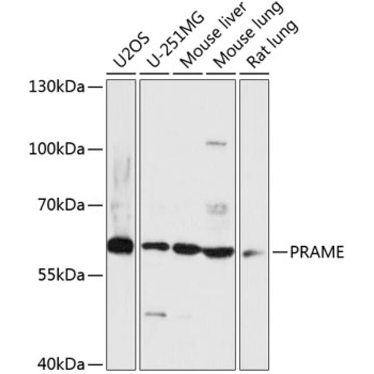 Western Blot - Anti-PRAME Antibody (A90604) - Antibodies.com