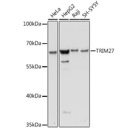 Western Blot - Anti-TRIM27 Antibody (A90605) - Antibodies.com