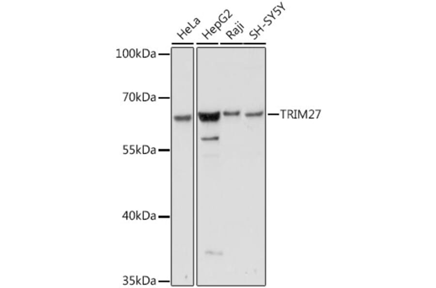 Western Blot - Anti-TRIM27 Antibody (A90605) - Antibodies.com
