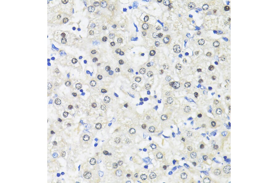 Immunohistochemistry - Anti-TRIM27 Antibody (A90605) - Antibodies.com
