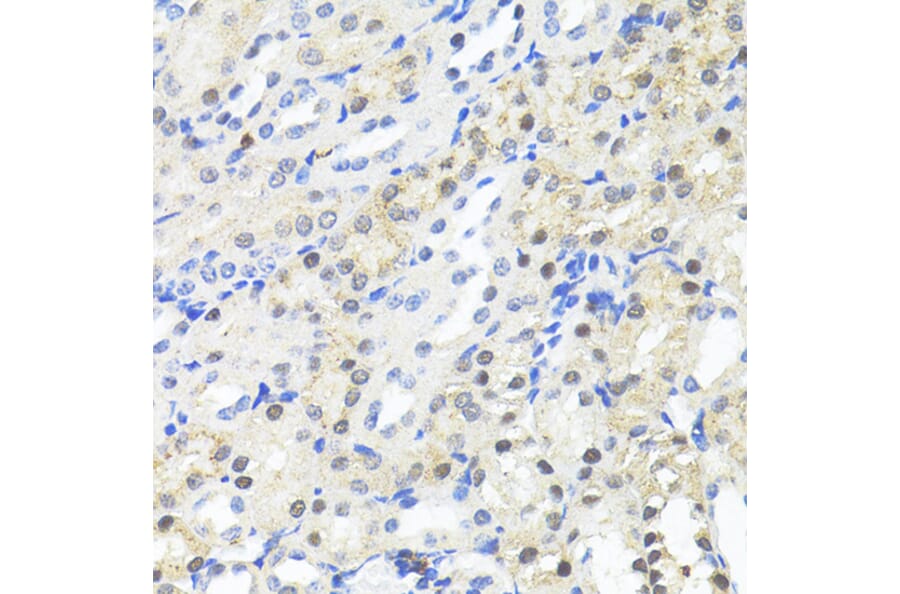 Immunohistochemistry - Anti-TRIM27 Antibody (A90605) - Antibodies.com