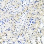 Immunohistochemistry - Anti-TRIM27 Antibody (A90605) - Antibodies.com