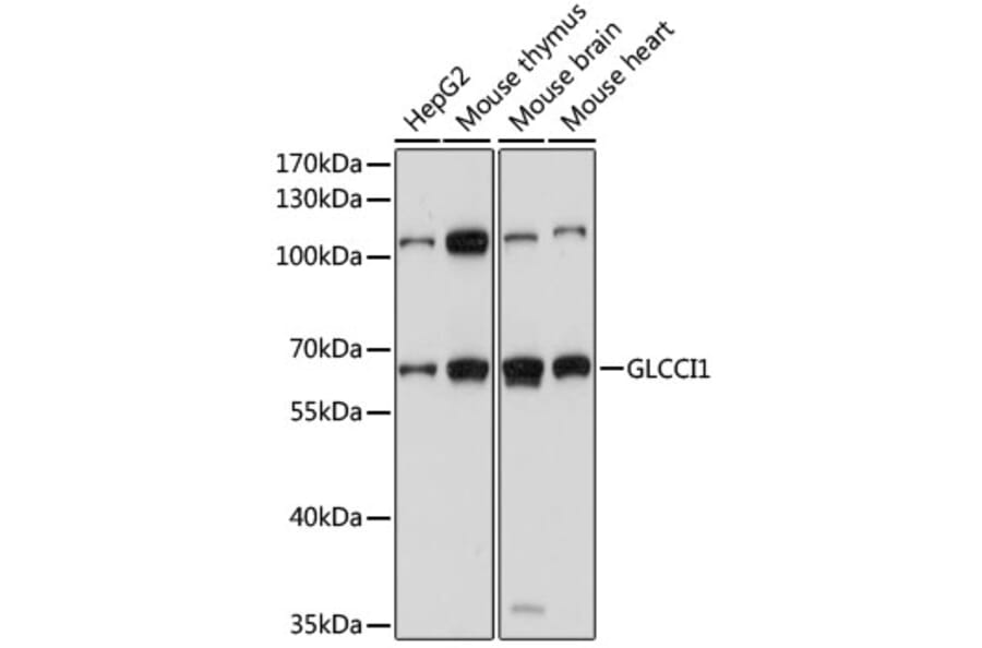 Western Blot - Anti-GLCCI1 Antibody (A90606) - Antibodies.com
