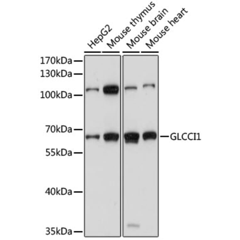 Western Blot - Anti-GLCCI1 Antibody (A90606) - Antibodies.com