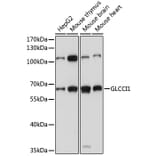 Western Blot - Anti-GLCCI1 Antibody (A90606) - Antibodies.com