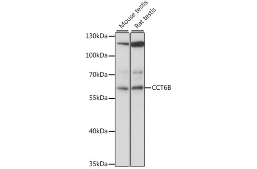 Western Blot - Anti-CCT6B Antibody (A90607) - Antibodies.com