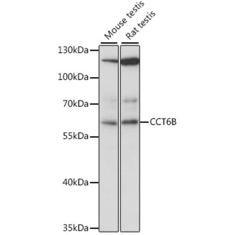Western Blot - Anti-CCT6B Antibody (A90607) - Antibodies.com