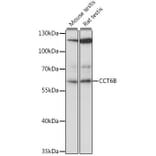 Western Blot - Anti-CCT6B Antibody (A90607) - Antibodies.com