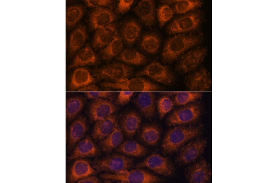 Immunofluorescence - Anti-CCT6B Antibody (A90607) - Antibodies.com
