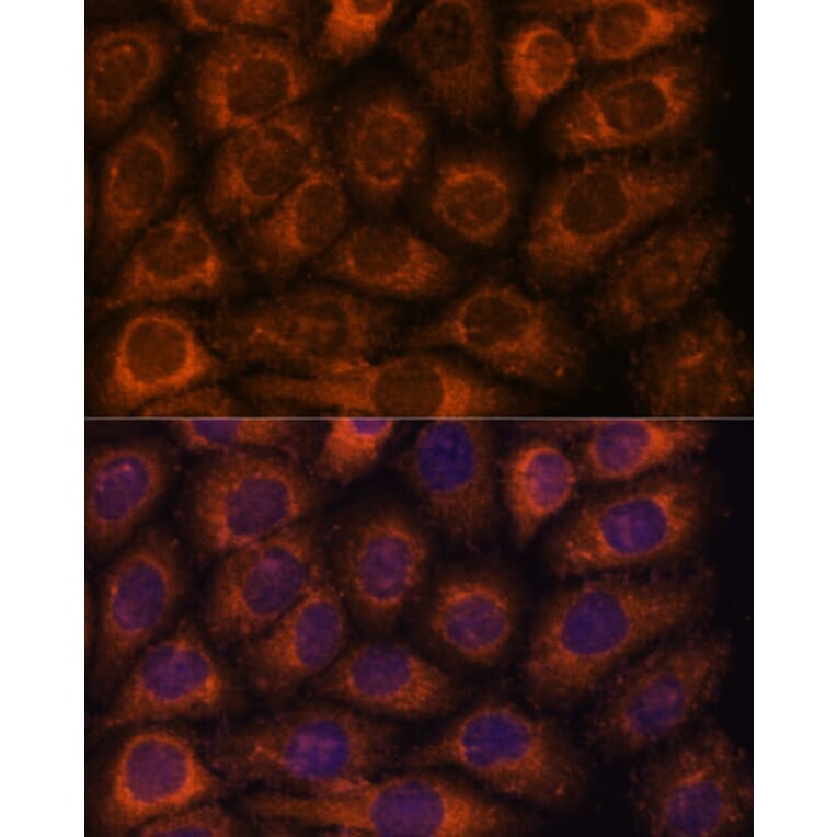 Immunofluorescence - Anti-CCT6B Antibody (A90607) - Antibodies.com