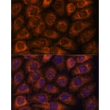 Immunofluorescence - Anti-CCT6B Antibody (A90607) - Antibodies.com