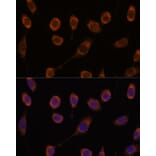 Immunofluorescence - Anti-CCT6B Antibody (A90607) - Antibodies.com