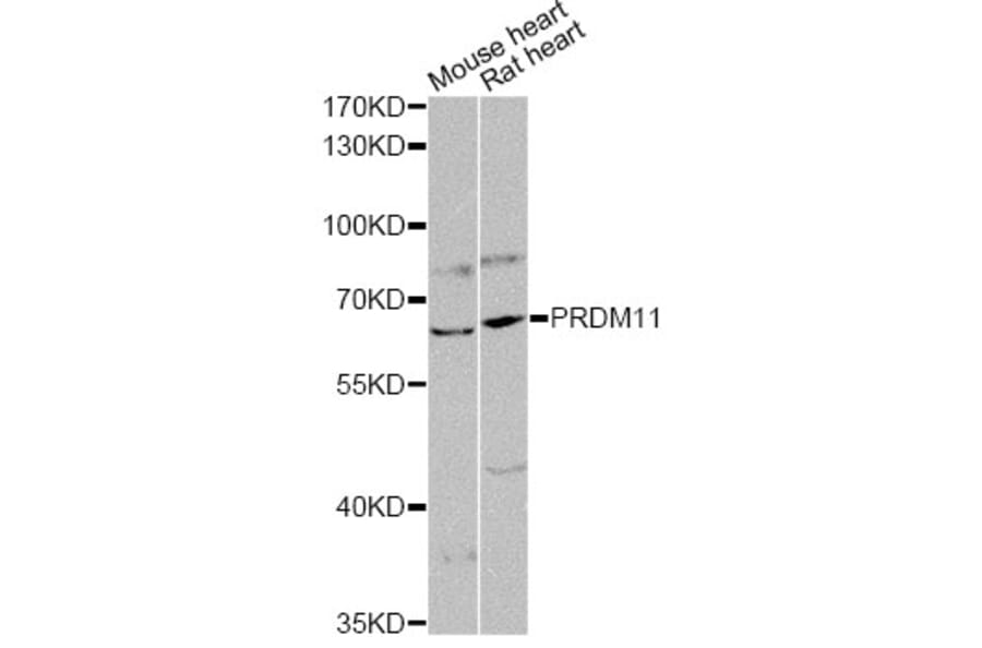 Western Blot - Anti-PRDM11 Antibody (A14143) - Antibodies.com