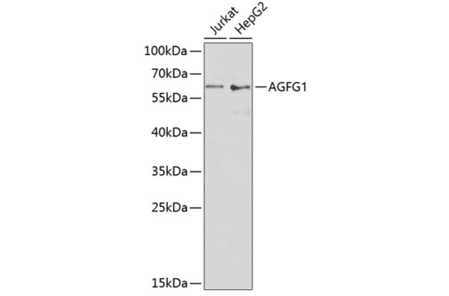 Western Blot - Anti-RAB Antibody (A90609) - Antibodies.com