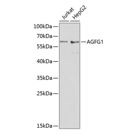 Western Blot - Anti-RAB Antibody (A90609) - Antibodies.com